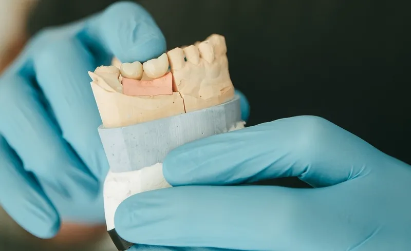 Sinuslift – Anheben des Kieferhöhlenbodens zur Implantation