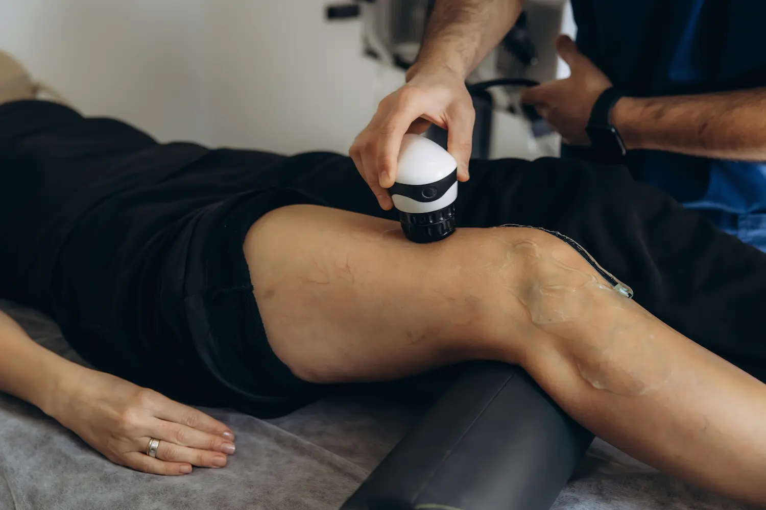 Woman receiving shockwave therapy with four adhesive electrodes on her leg for pain relief.