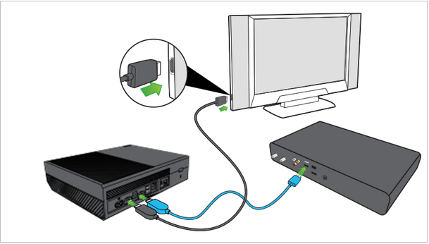 Illustration of set top box connected to XBox One, with Xbox One connected to the television with HDMI