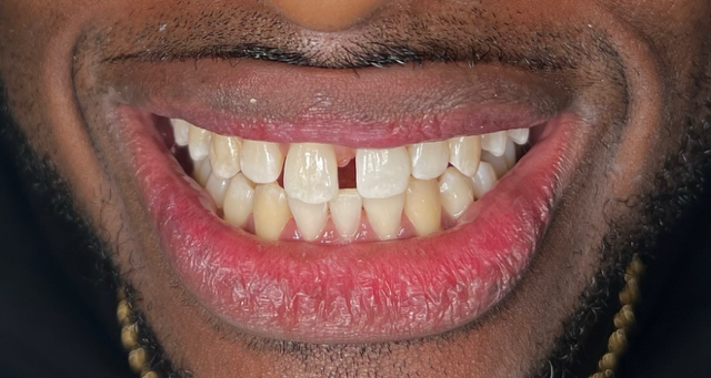 Services - Orthodontics