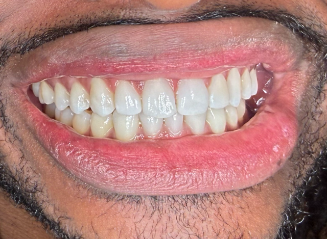 Services - Orthodontics