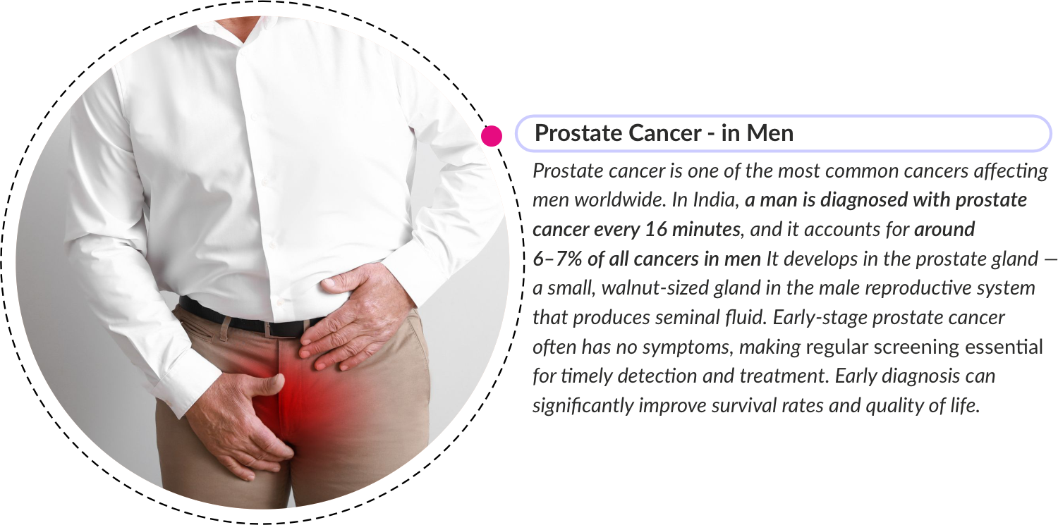 prostate cancer banner