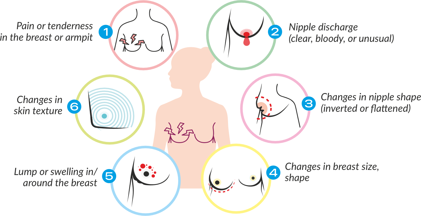 breast cancer examine