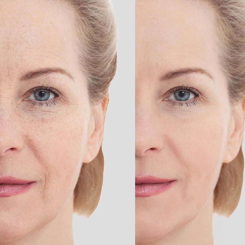 Allowlisting Strategy For Beauty Brand Purity Woods 