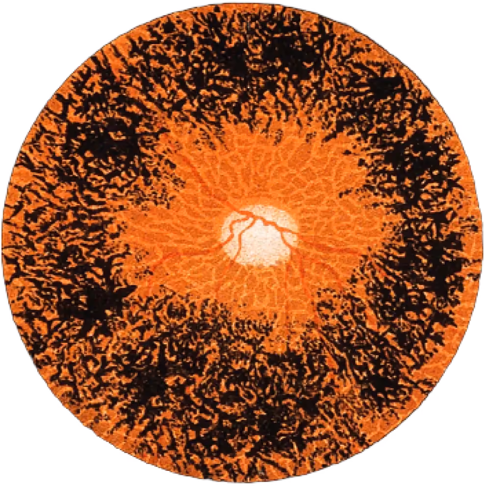 Right portion of retinal scan imagery