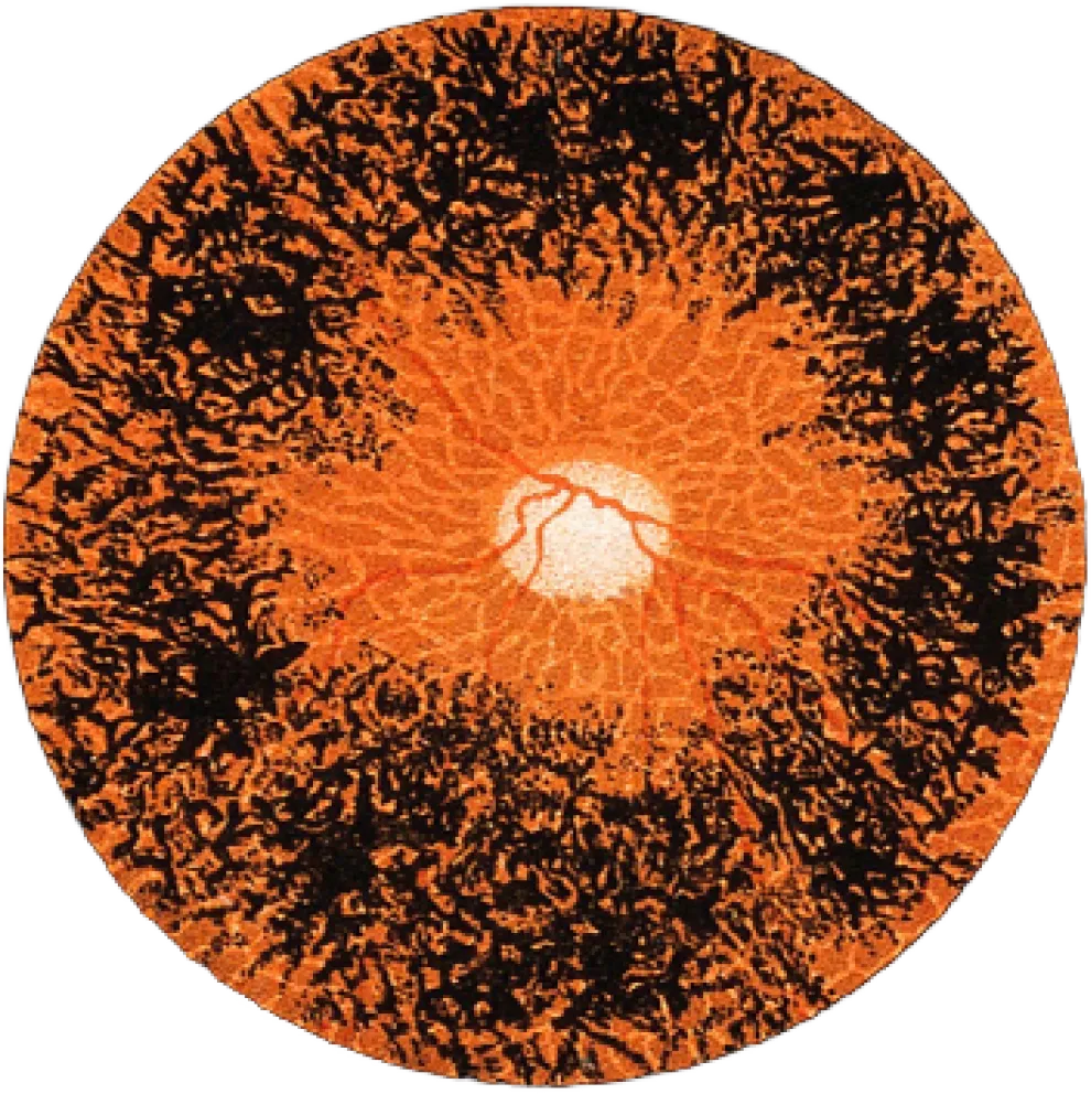 Right portion of retinal scan imagery