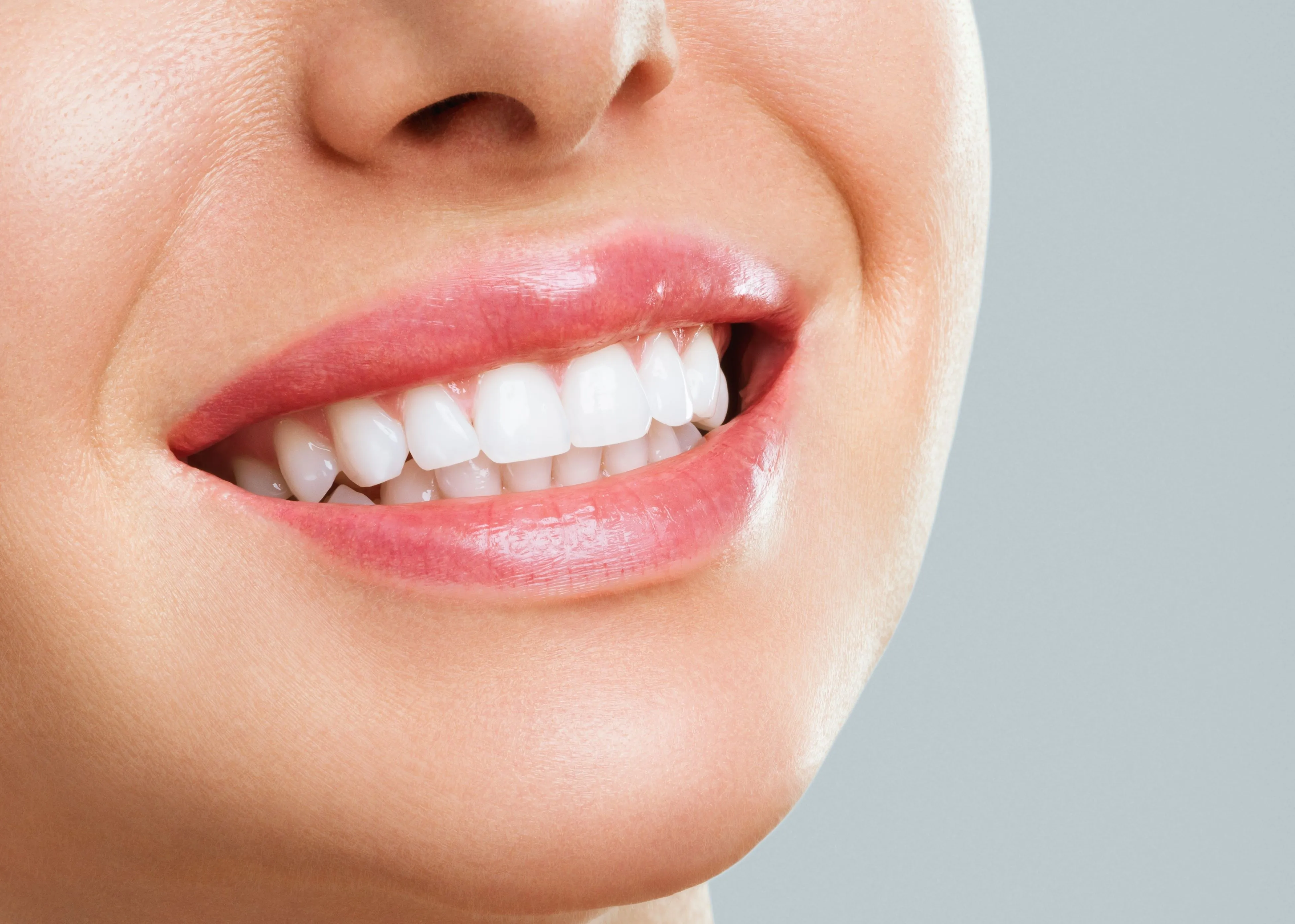 A close up of a woman's smile with white teeth.