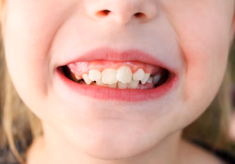 Child's smile