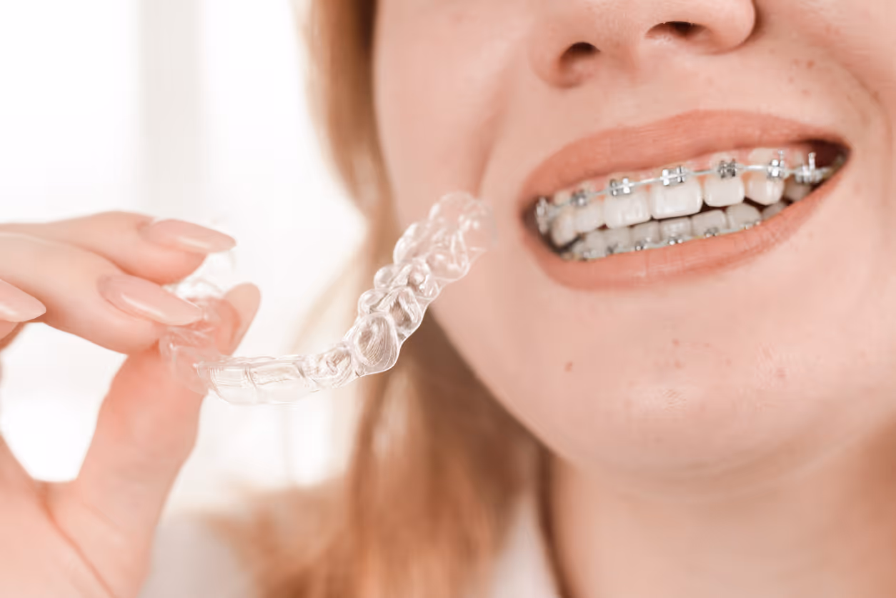 How Invisalign and Braces Work