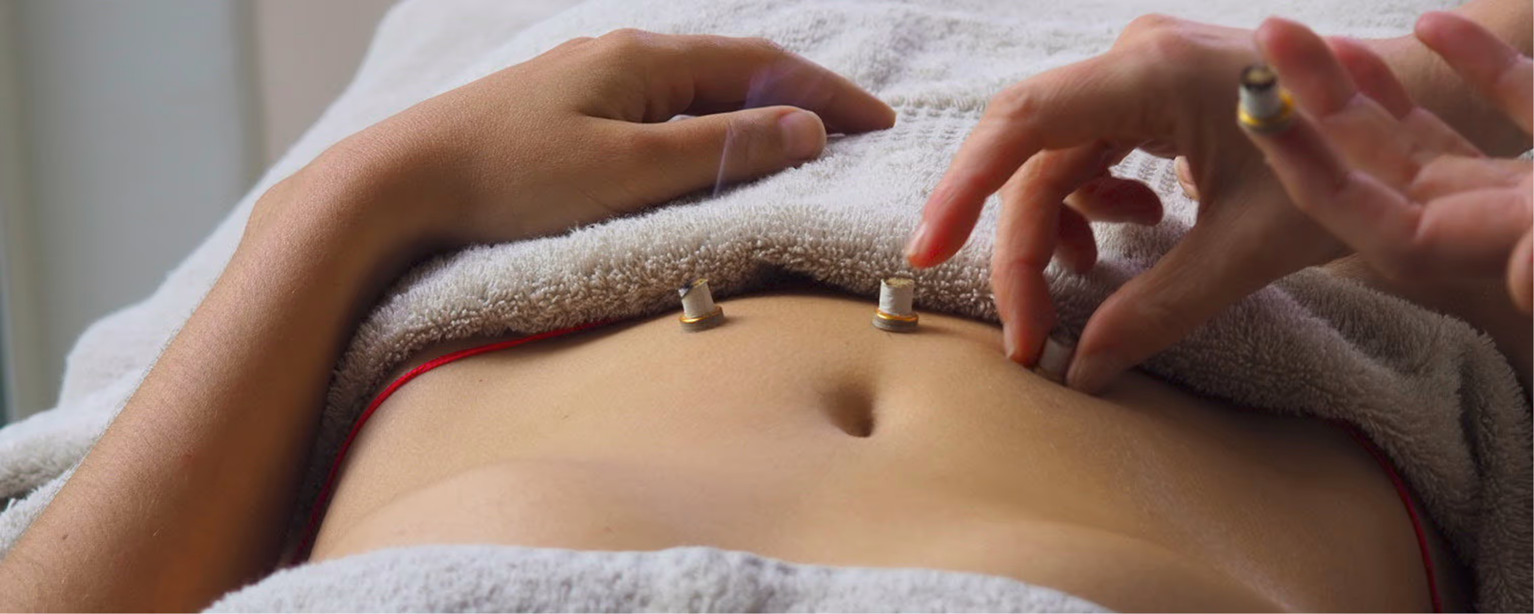 Muestra del tratamiento de Moxibustion en el abdomen.