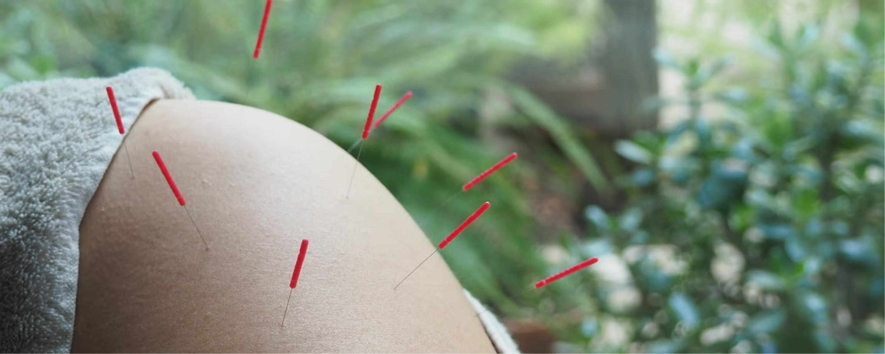 Acupuntura y Belleza en Ibiza