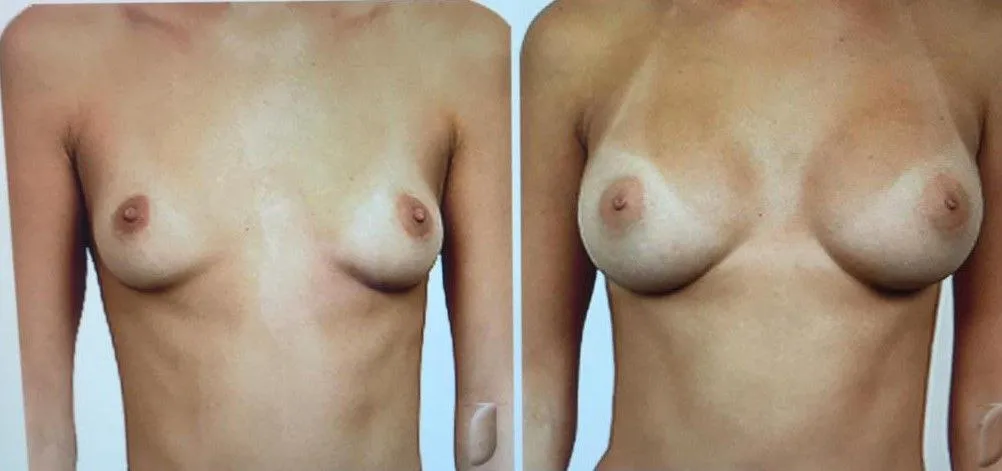 plastic-surgery