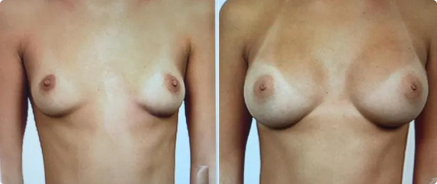 plastic-surgery