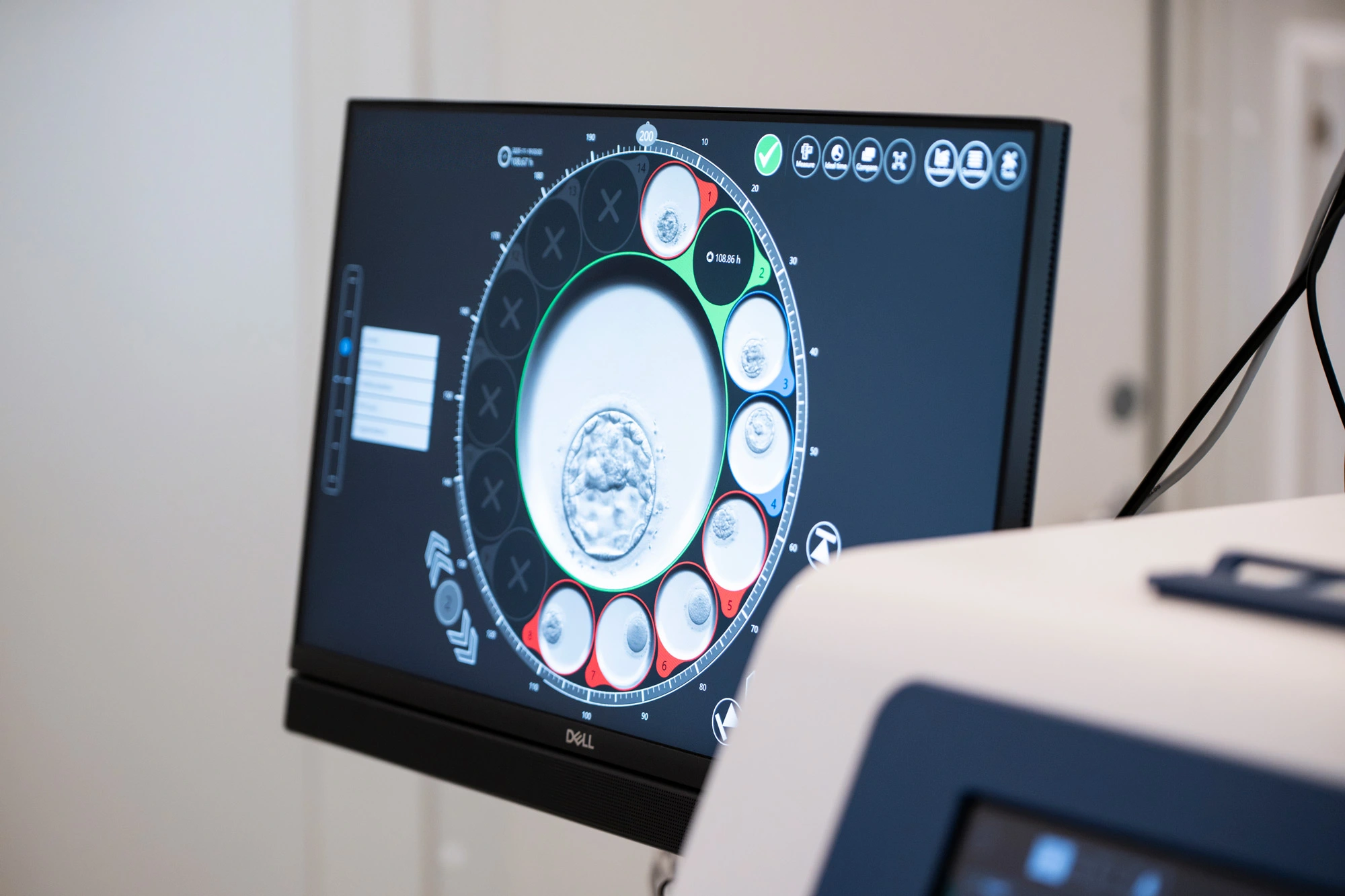 Tidsforløpsinkubator for overvåking av embryoer i IVF-laboratoriet