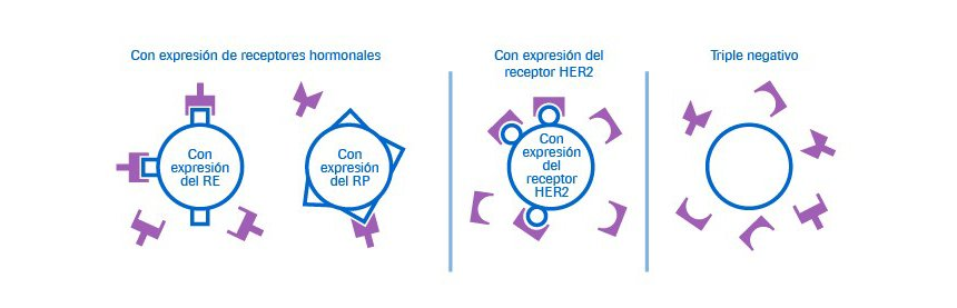 🧬 ¿Qué tipo de cáncer tengo? HER2+, luminal, triple negativo... explicado fácil