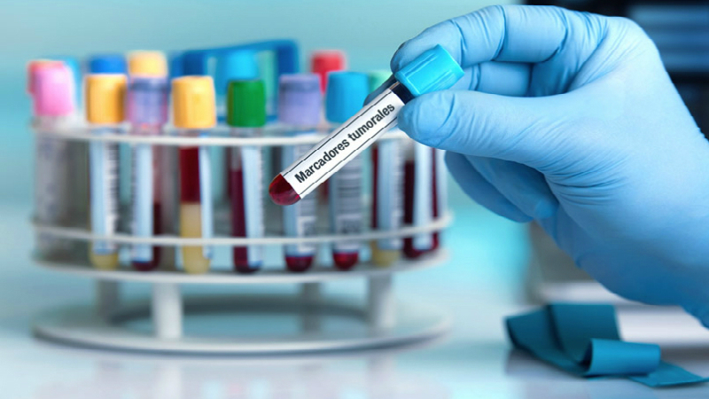 ¿Marcadores tumorales elevados? Qué significan y cuándo preocuparse