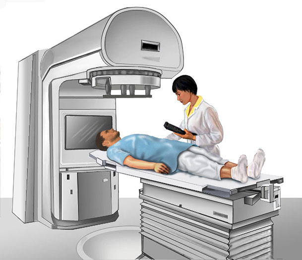 Radioterapia externa: cómo prepararte, qué sentirás y qué cuidados tener durante el tratamiento