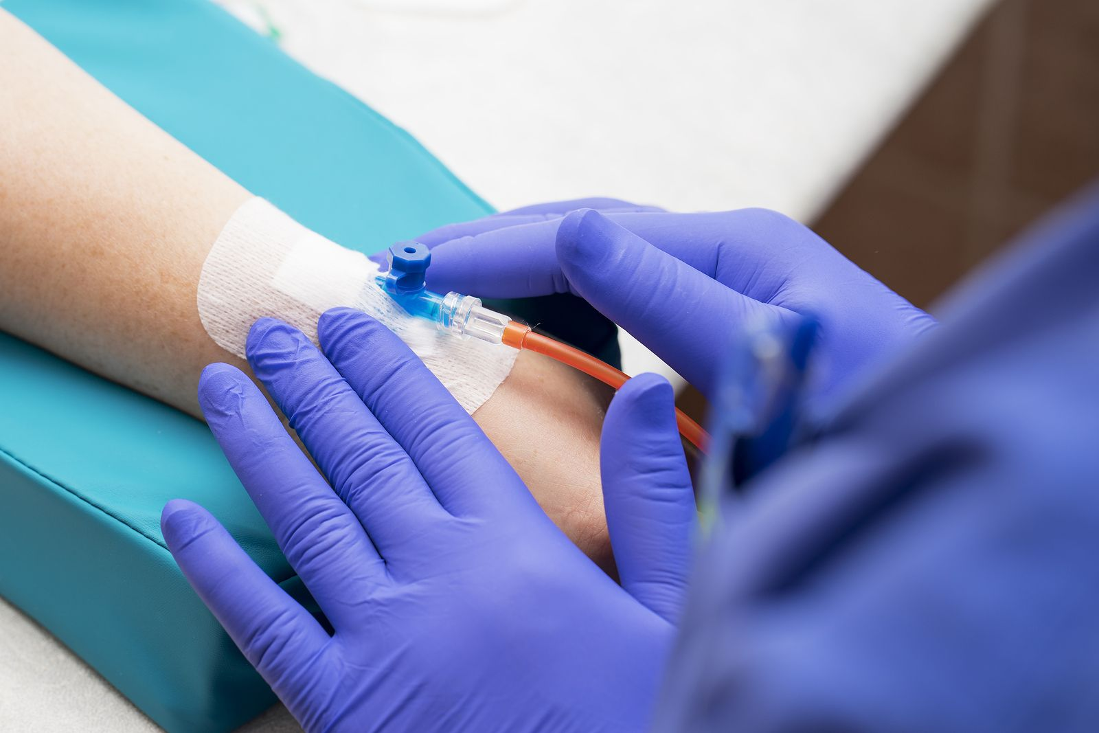 ¿Por qué me arden las venas después de la quimioterapia? Cómo cuidarlas y evitar complicaciones