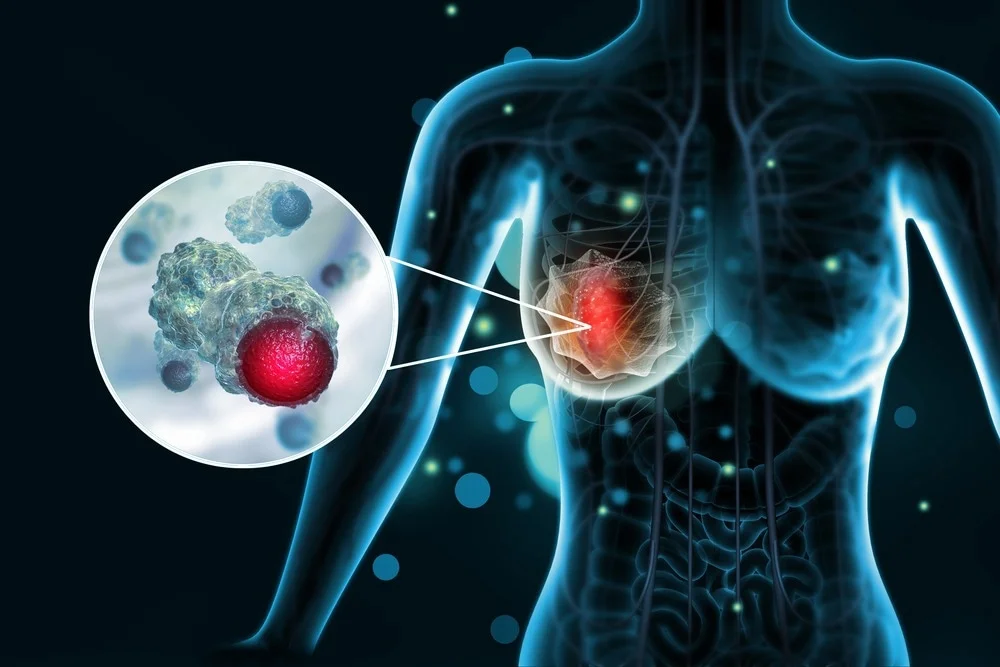  🧬 ¿Qué significa que mi tumor sea hormonosensible? Guía clara para entenderlo y actuar