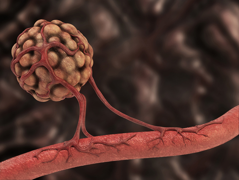 🌱 Terapias antiangiogénicas: cómo “cortan el alimento” al cáncer