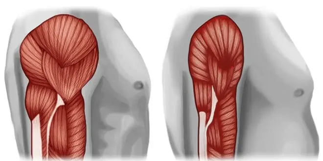 💪 ¿Qué es la sarcopenia oculta y cómo detectarla en pacientes oncológicos aunque no haya pérdida de peso?