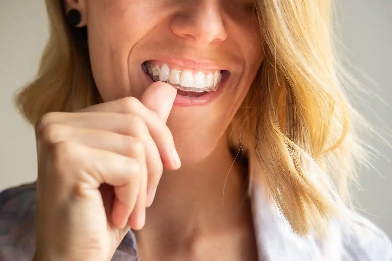 Woman showing her teeth while demonstrating her smile.