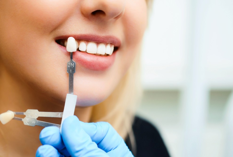 Is Cosmetic Dentistry Right for You?