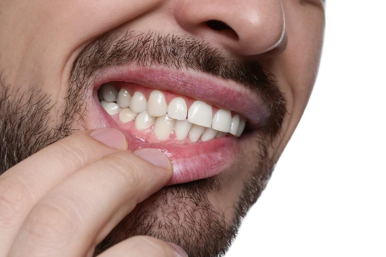 How to Prevent Gum Disease