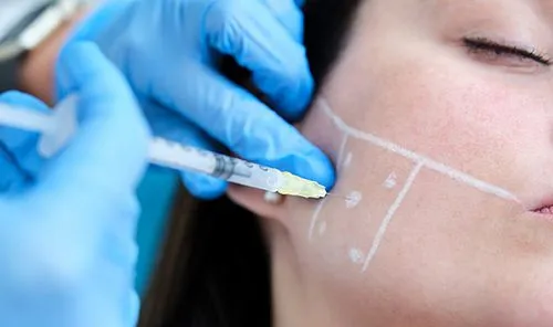injection of jawline