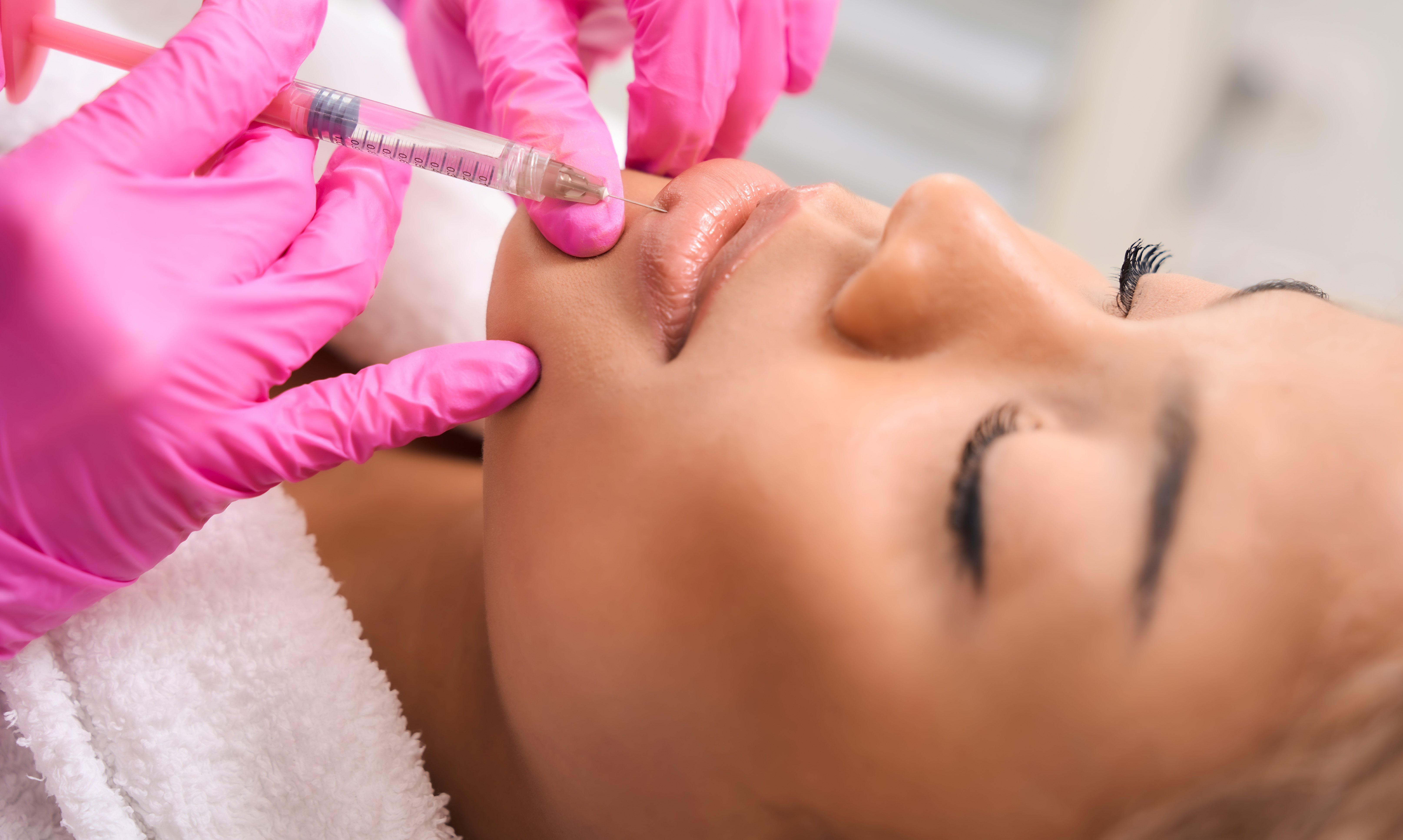 APPLYING DERMAL FILLER WITH A WOMAN