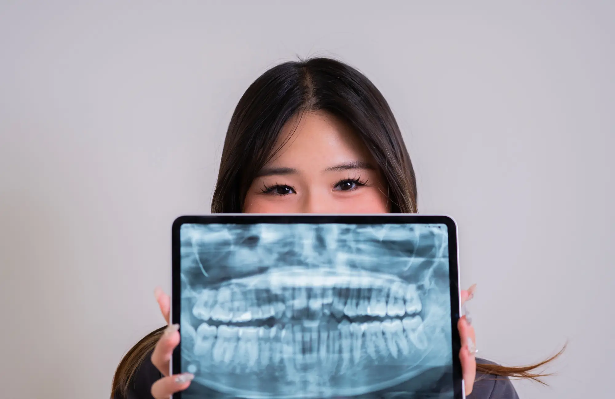 Woman holding a dental X-ray in front of her face, showing teeth clearly.