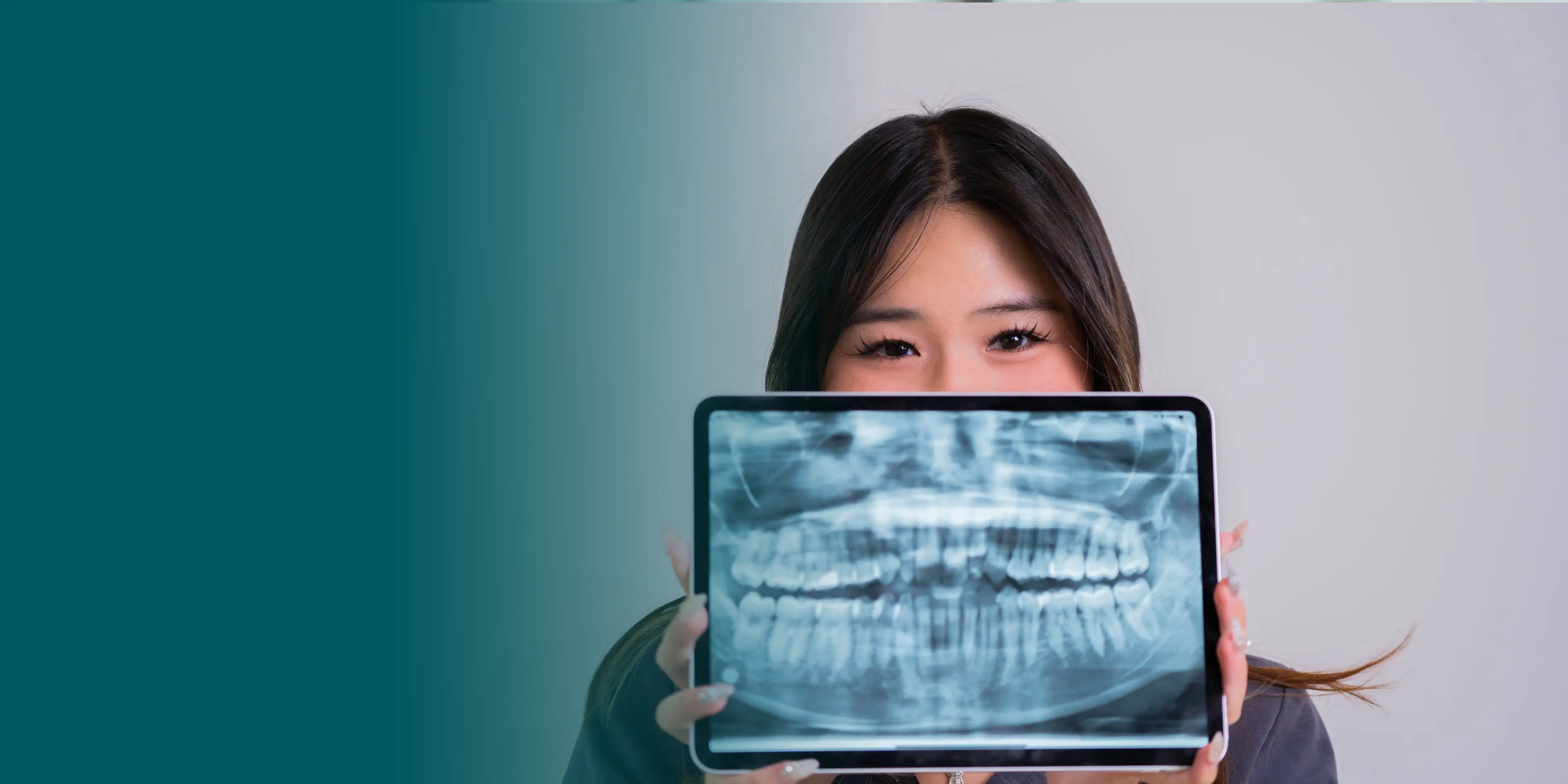 A person holds a tablet showing a dental X-ray in front of their face.