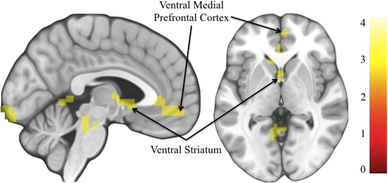 scan of brain regions activated with positive affirmations