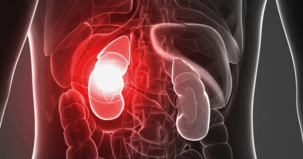 Coping with Acute Kidney Injury