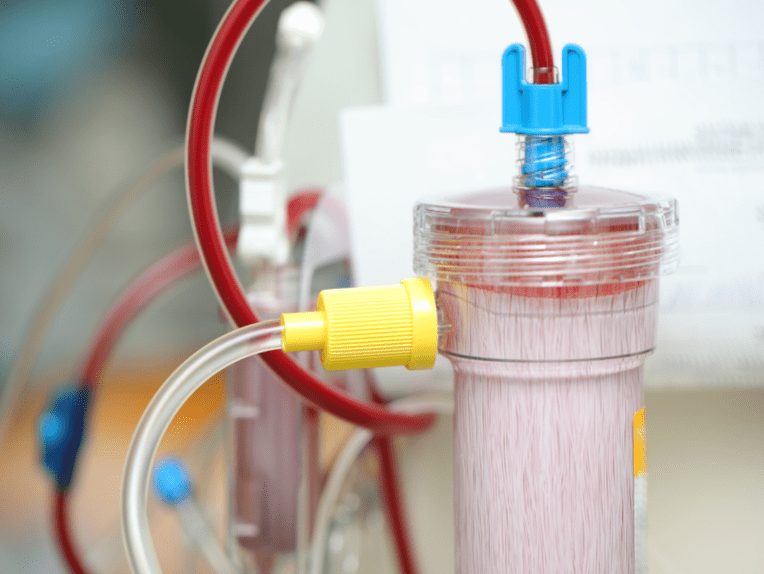 New Material Technologies in Dialysis Filters