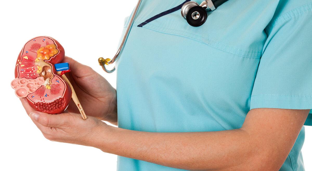Medical Interventions for Chronic Kidney Stones