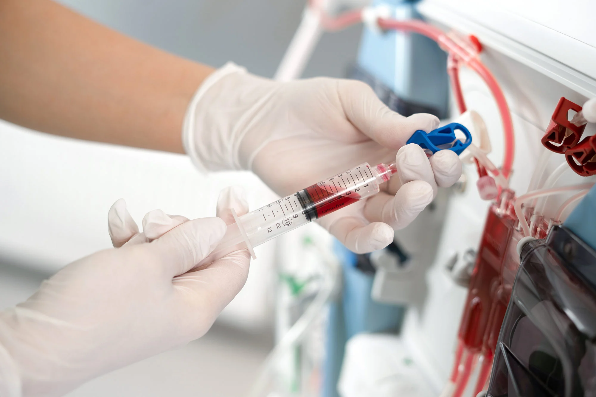 Dialysis and Magnesium Balance