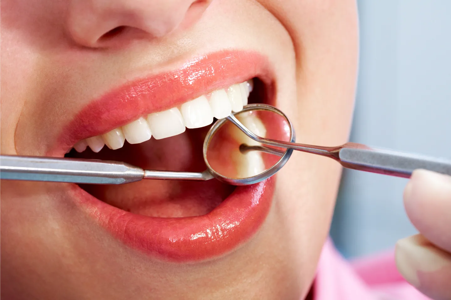 7 Reasons Why Regular Dental Check-Ups Matter More Than You Think