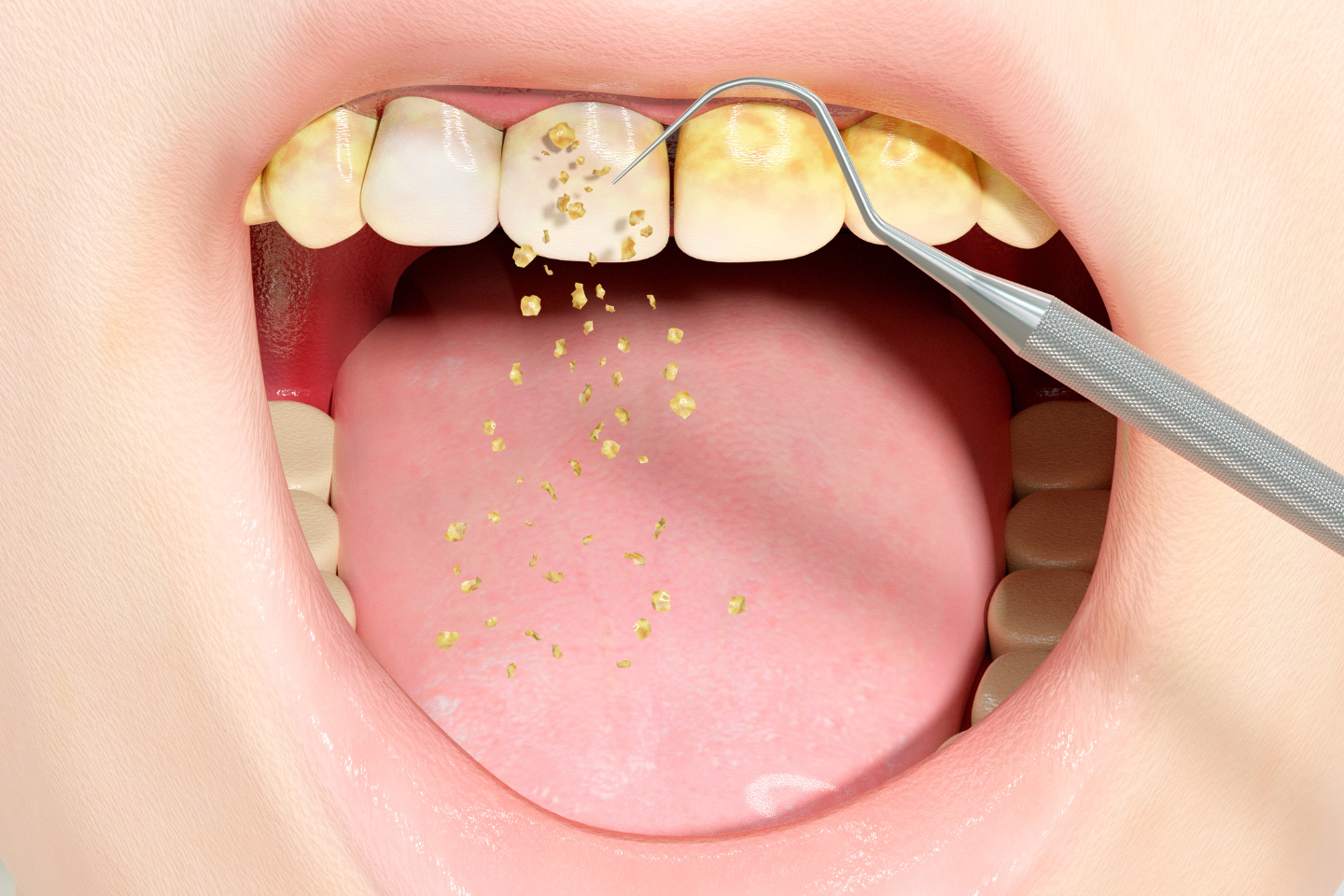 Best Ways to Clean Tartar Off Teeth and Prevent Buildup