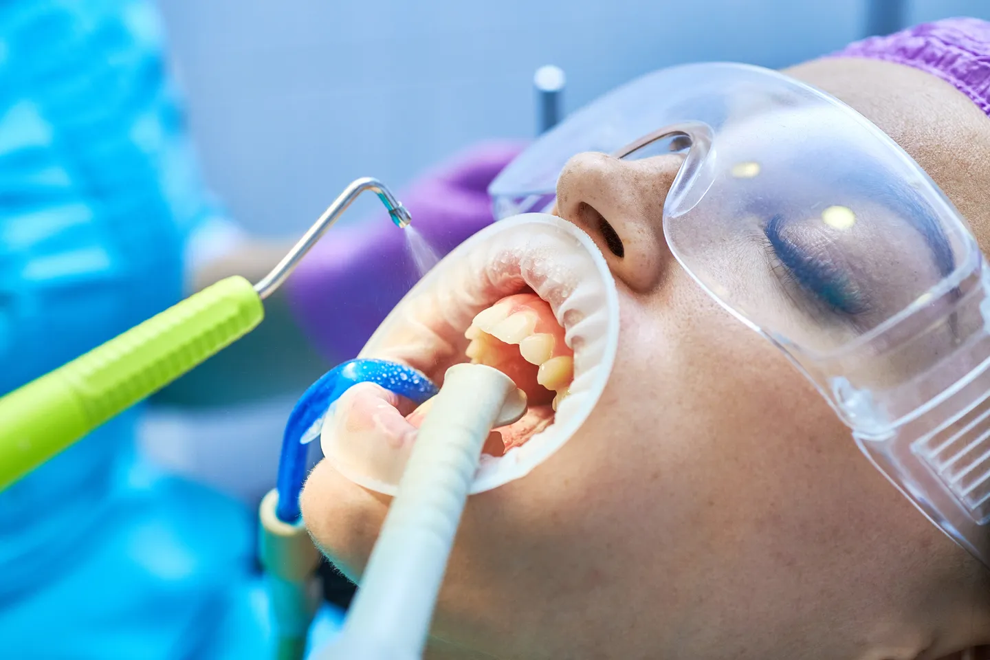 Airflow® Tooth Polishing in Leeds