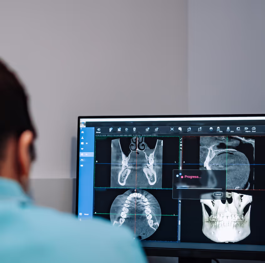 A doctor's watching X-Rays