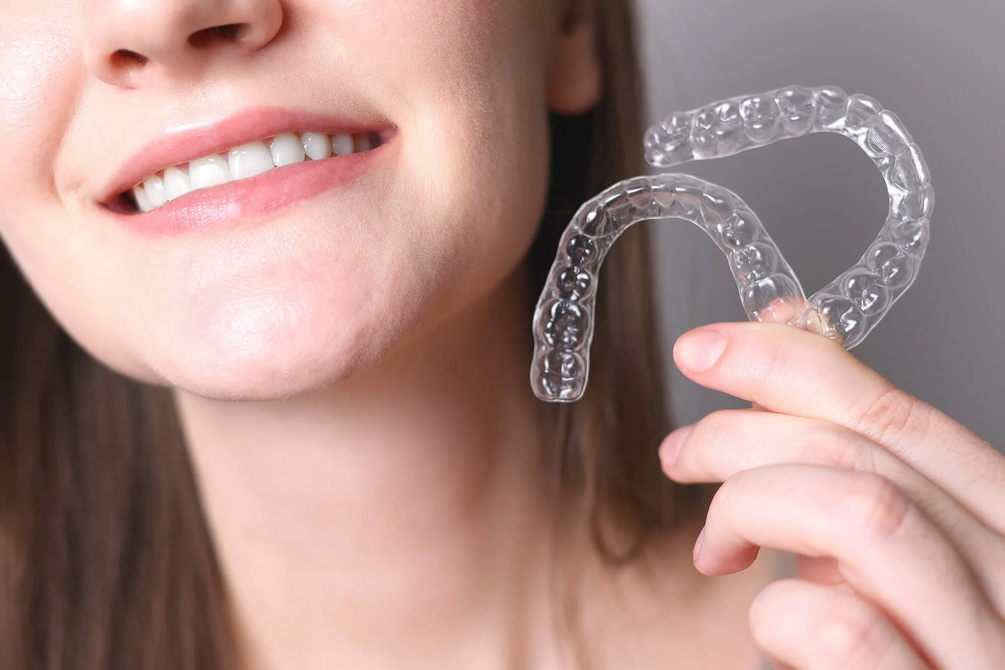 new clear aligners spartanburg sc