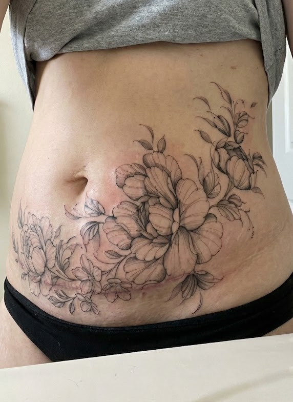 After - scar camouflage by Monique