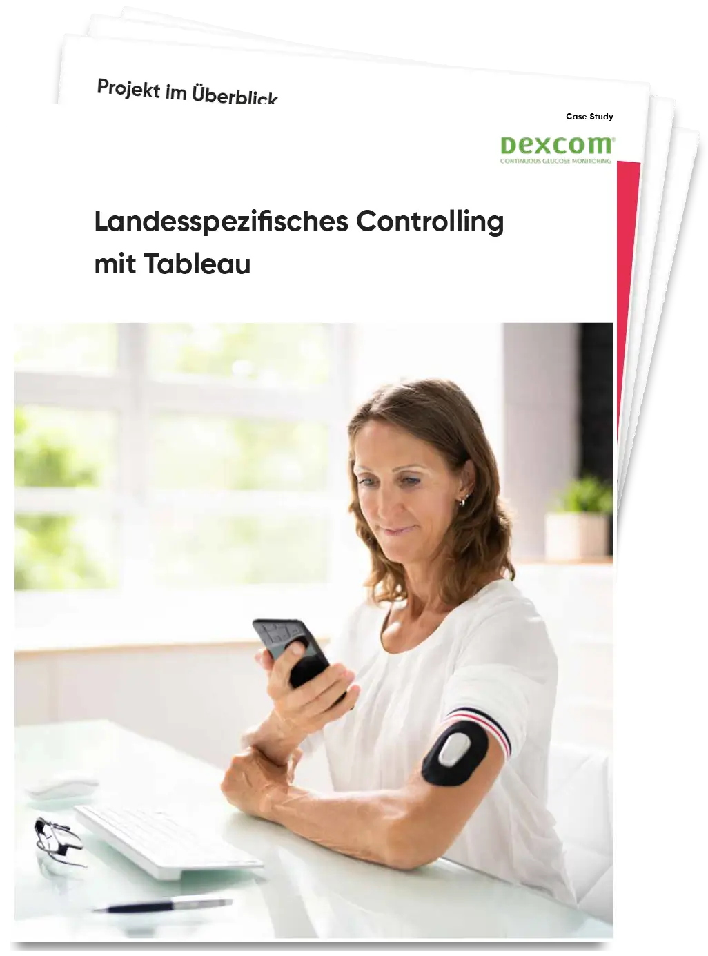 Case Study Controlling mit Tableau bei dexcom, taod Consulting