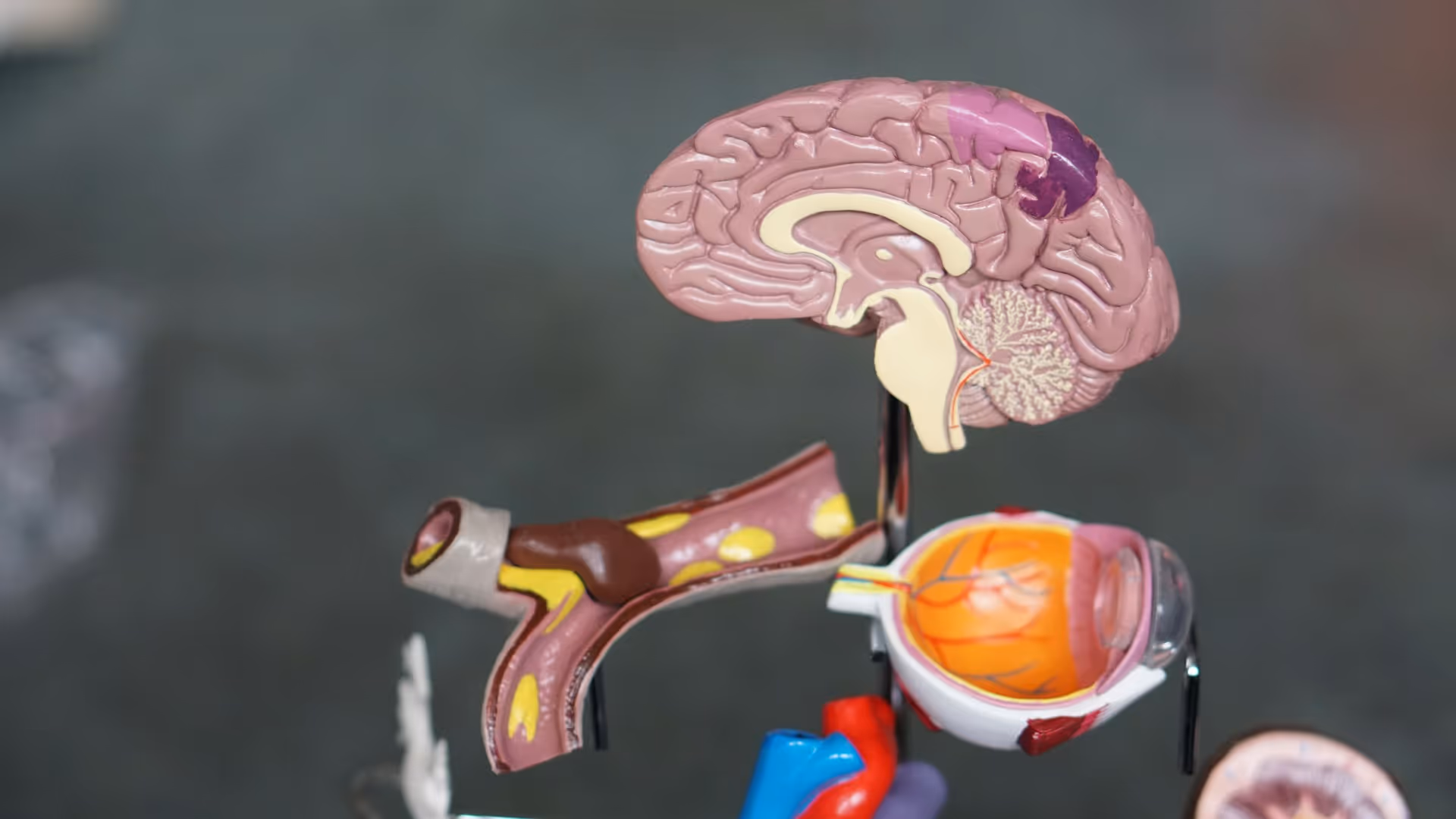 Support nerve health, reduce inflammation, and combat fatigue with this supplement protocol for individuals with Multiple Sclerosis.