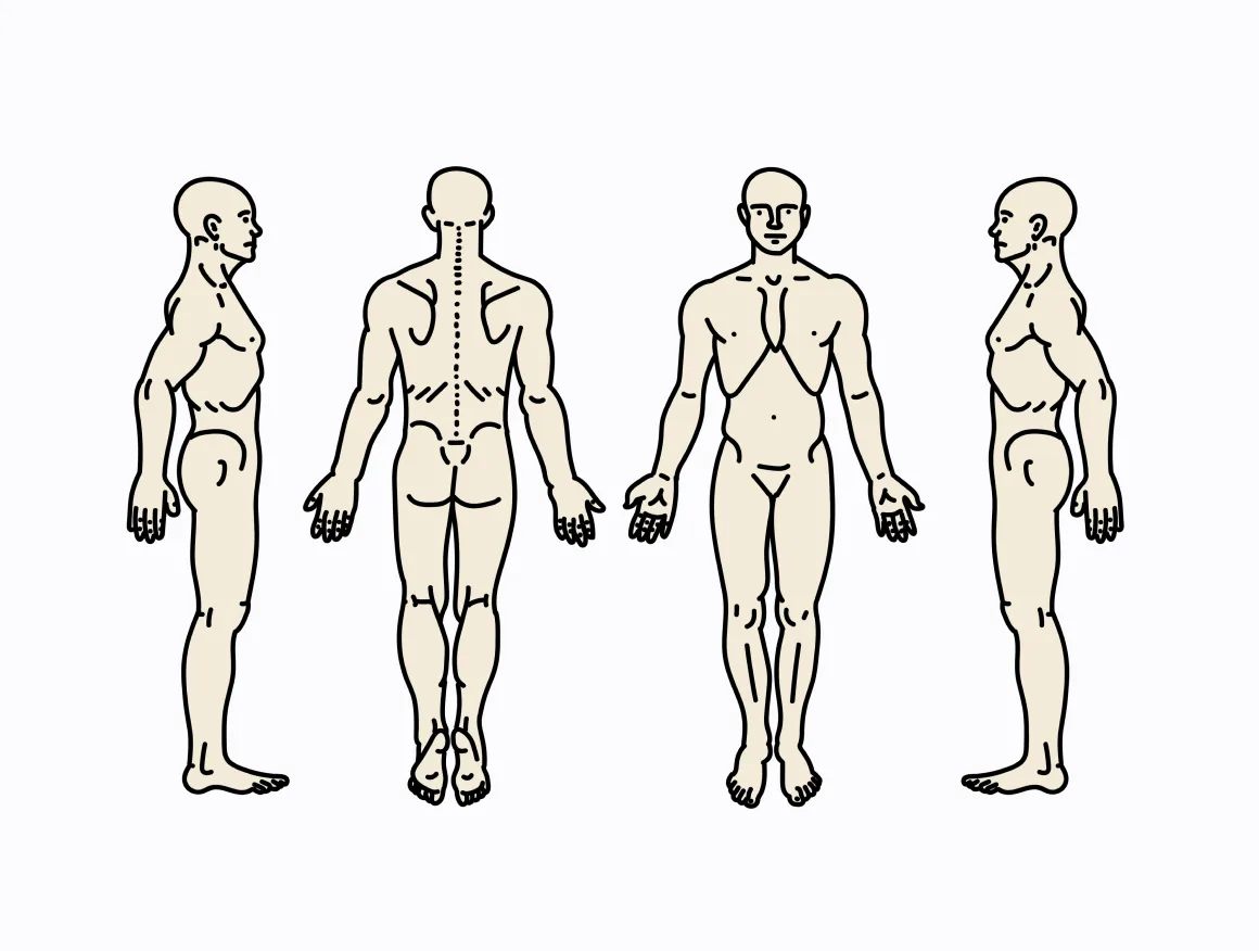 A medical diagram of a male body, shown in four angles – right side, back, front and left side