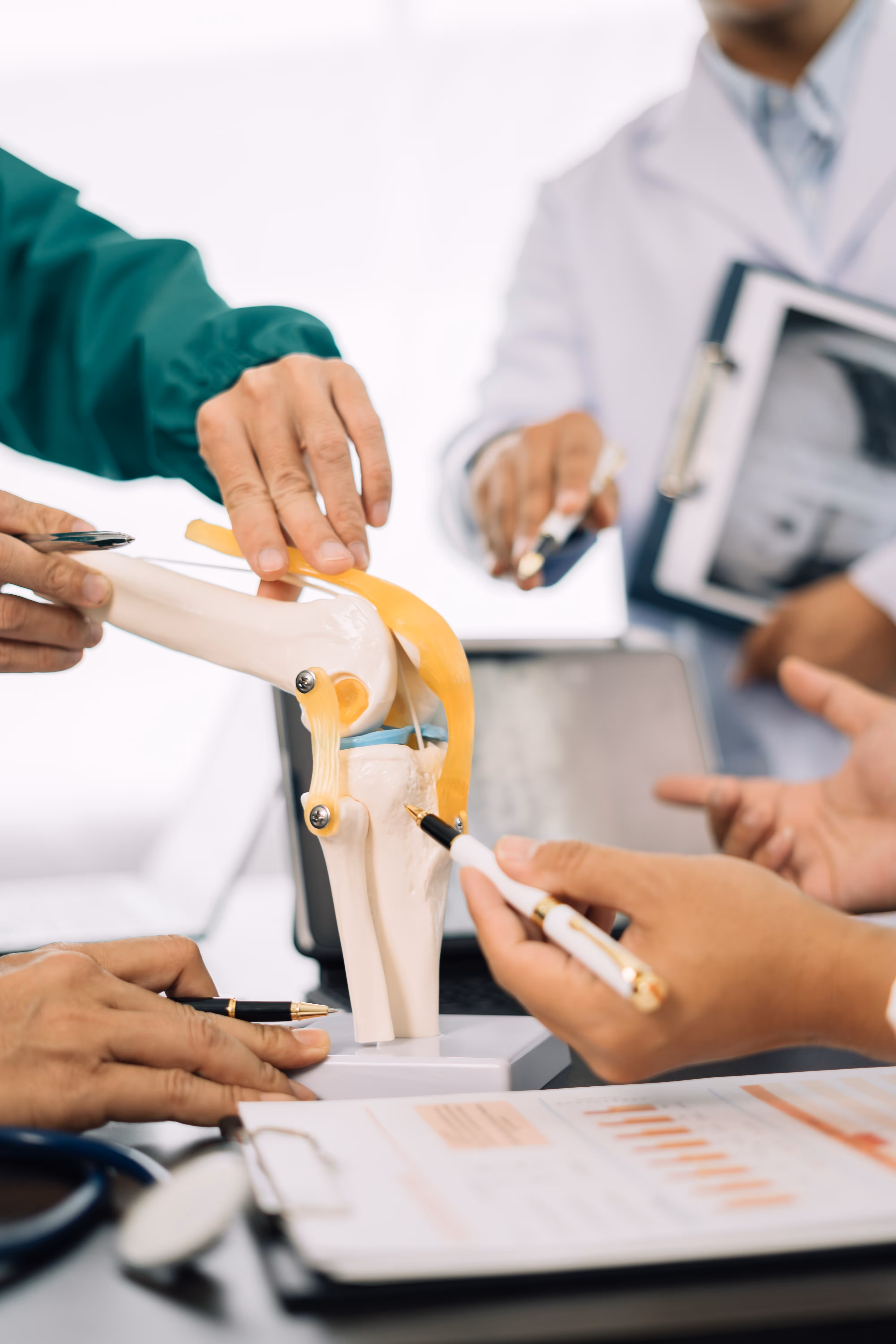 Medical professionals analyzing anatomical knee joint model during meeting