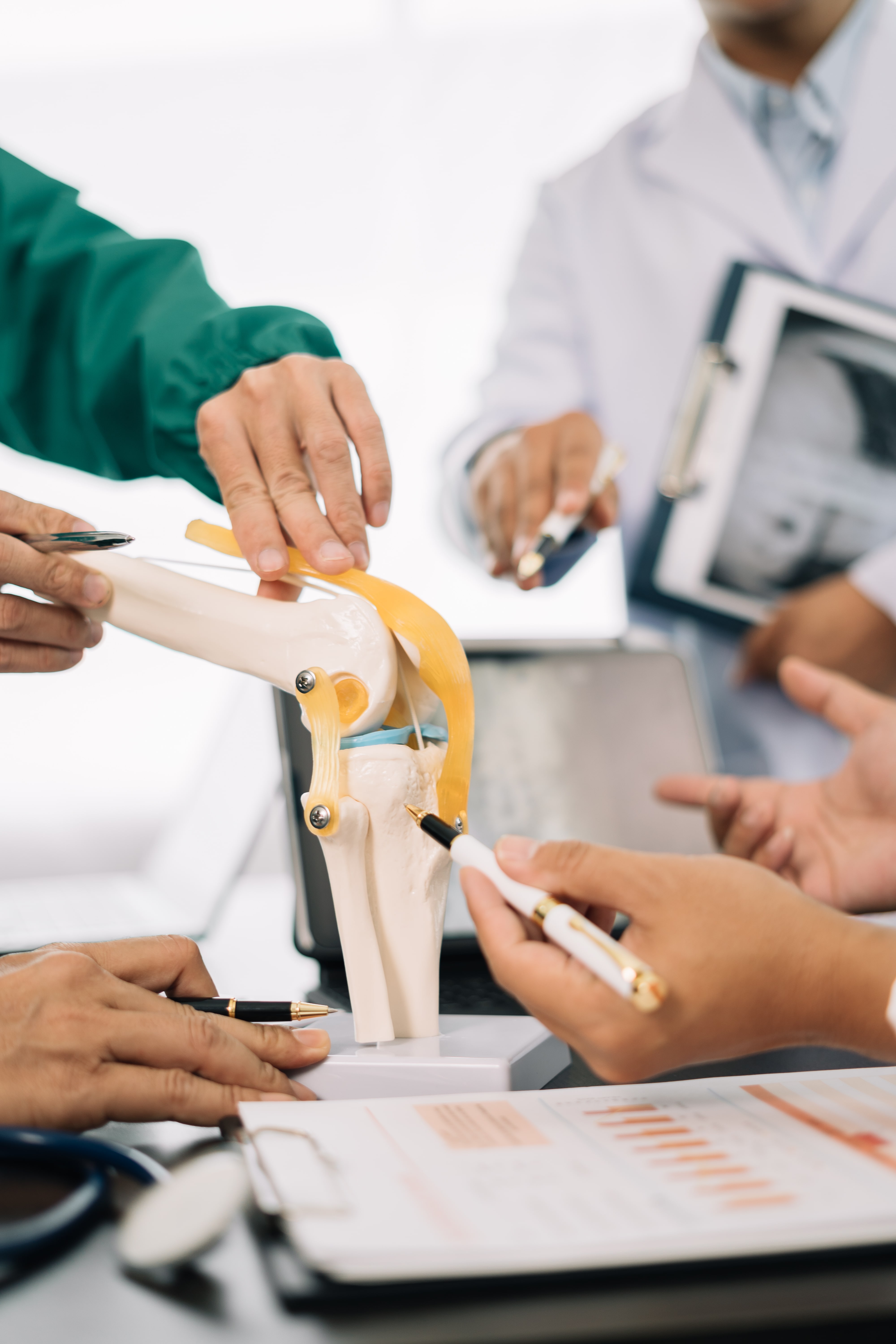 Medical professionals analyzing anatomical knee joint model during meeting