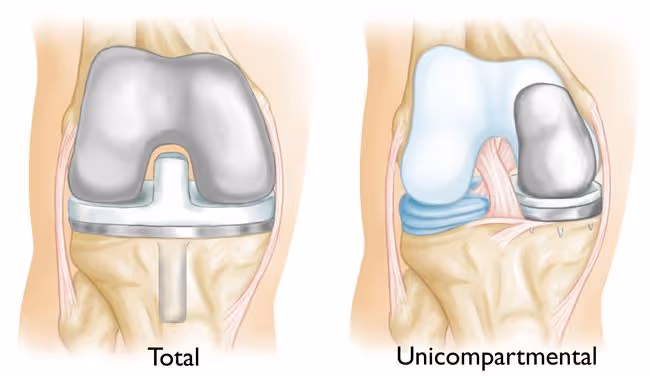 diagram of knee joint