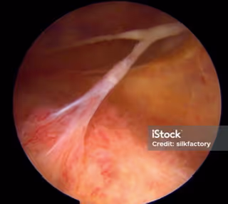 Endoscopic view of internal body tissue with branching biological structure